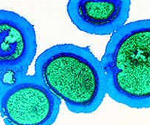 Mytob: Precursors to a 'Super Worm'? Experts seem to think so.