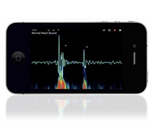 Qualcomm offers $10 million for working Tricorder